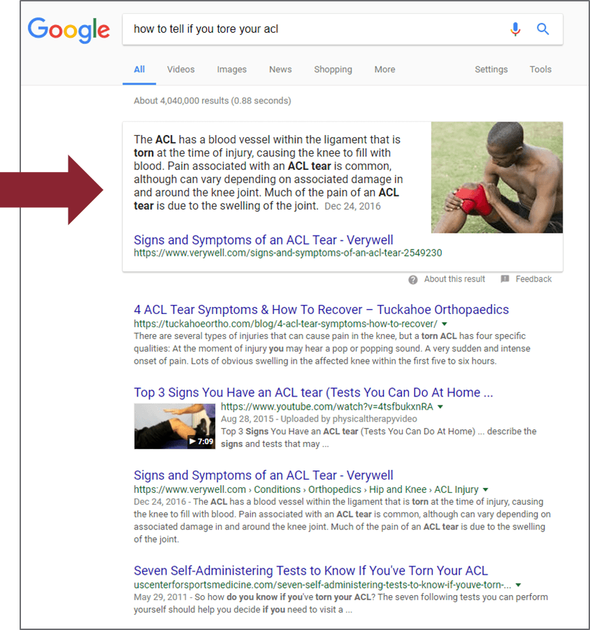 Screenshot of Google search results page for the query 'How to tell if you tore your acl'